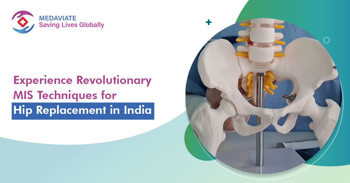 Hip Replacement Cost in India