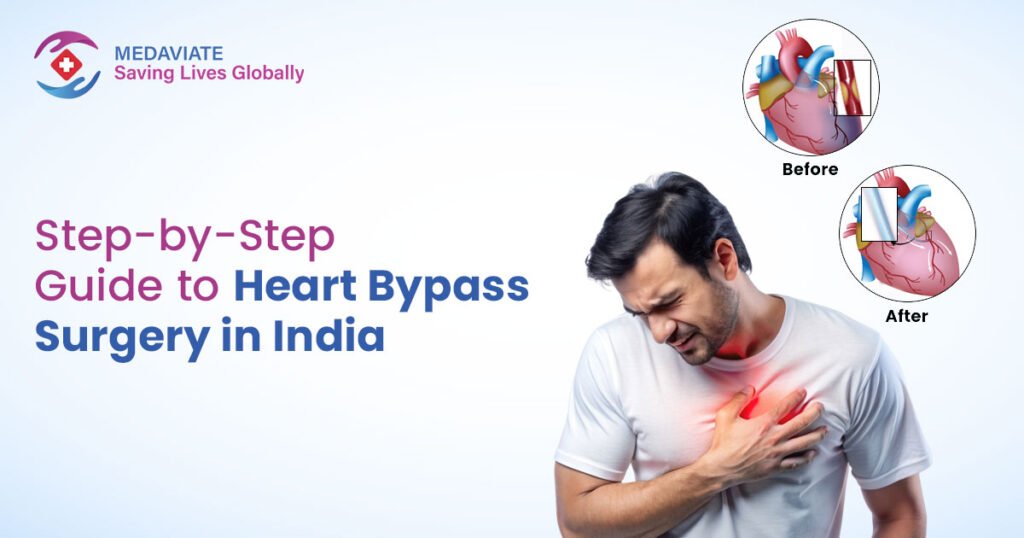 Step by Step Guide to Heart Bypass Surgery in India