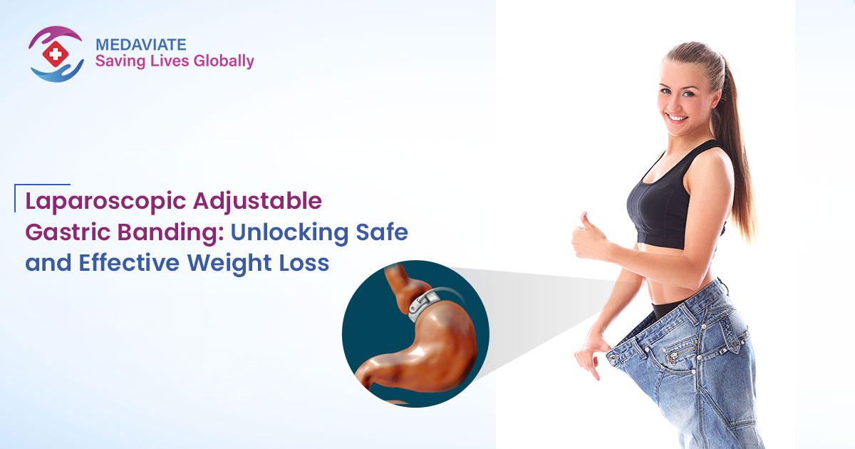 Laparoscopic Adjustable Gastric Banding: Unlocking Safe and Effective Weight Loss