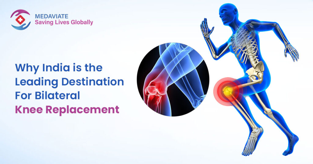 Why India is the Prime Destination for Bilateral Knee Replacement